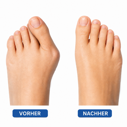 Relifix™ Hallux Korrektor Pro