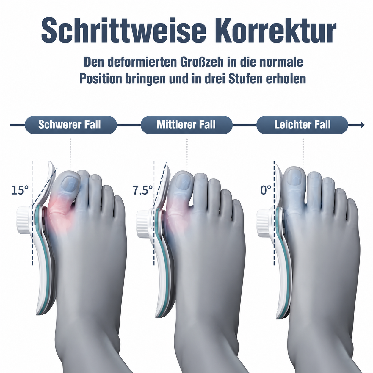 Relifix™ Hallux Korrektor Pro